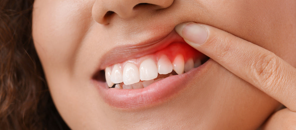 teeth with cavities